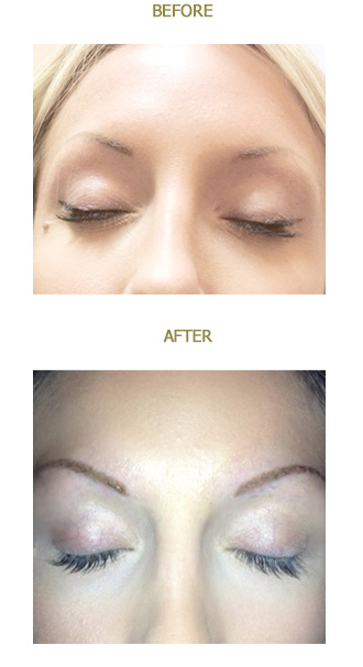 before-after-eyebrow3