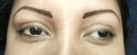 Eyebrows/Correction AFTER