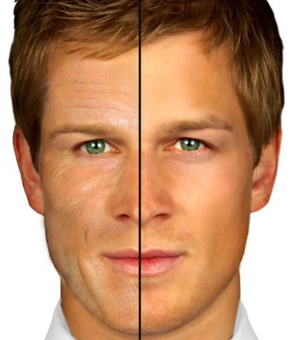 Men's Skin Care Facials Los Angeles Brentwood