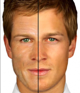 Mens Facial Before After